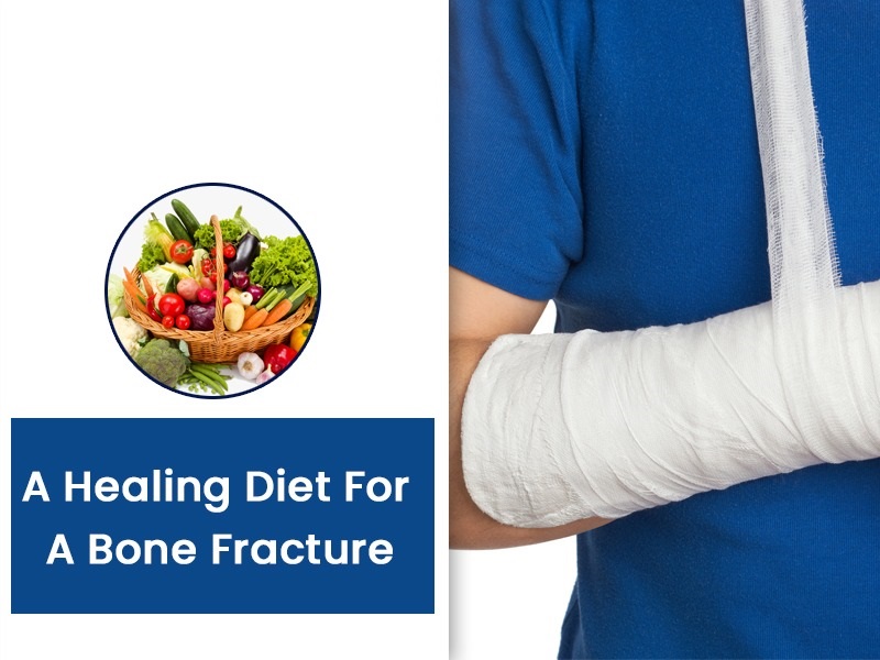Bone Fracture Healing Diet and Food