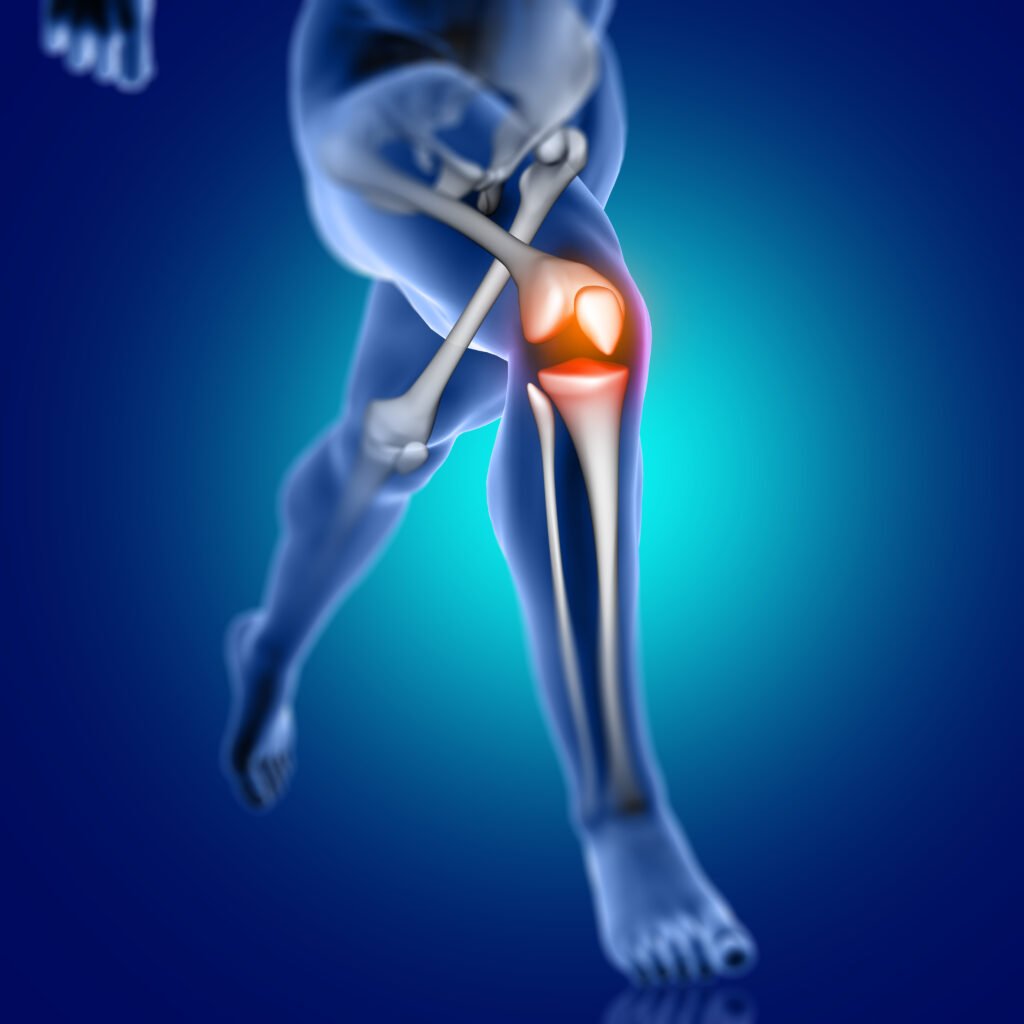 TYPES OF SPORTS INJURIES