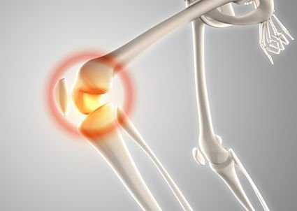 COMMON SYMPTOMS OF OSTEOARTHRITIS