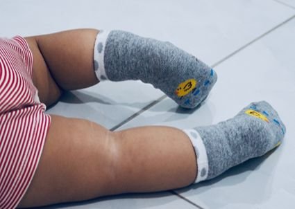 COMMON PEDIATRIC ORTHOPEDIC CONDITIONS