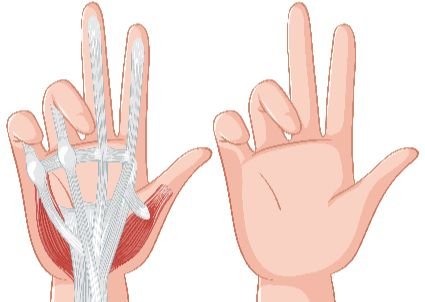 SIGNS YOU MAY NEED ARTHROSCOPY SURGERY