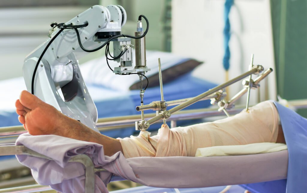 Before and After Knee Replacement Surgery