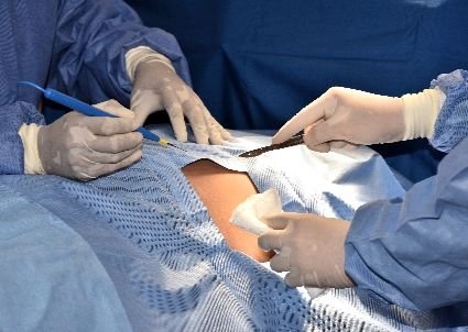TYPES OF LABRAL TEAR OF HIP TREATMENT