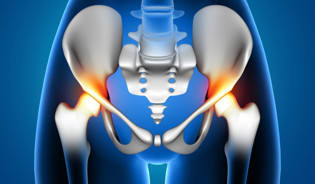 Treatment Options for Hip Labral Tear