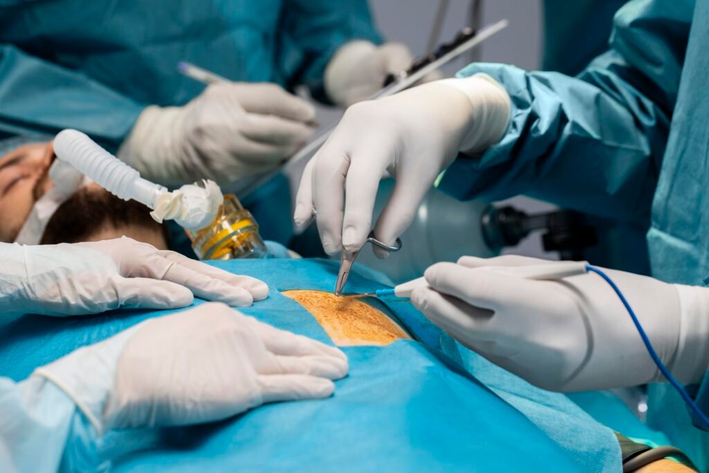 Arthroscopy Surgery Recovery Time