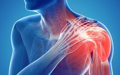 Shoulder Arthroscopy