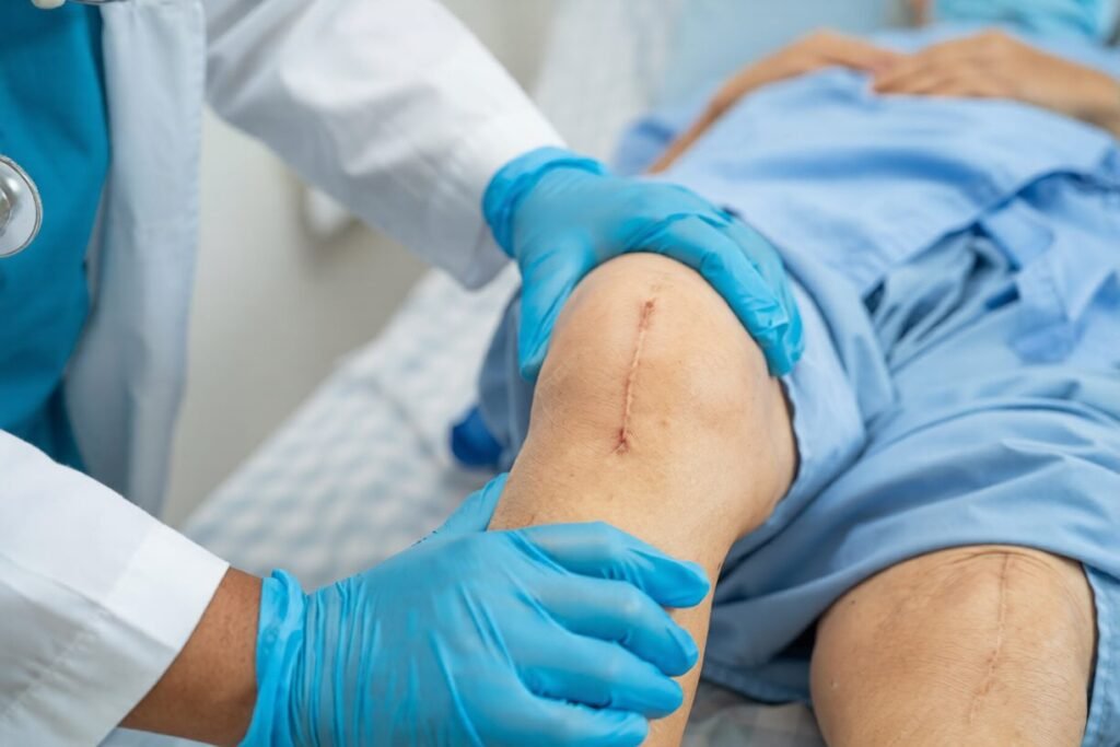 Knee Ligament Surgery