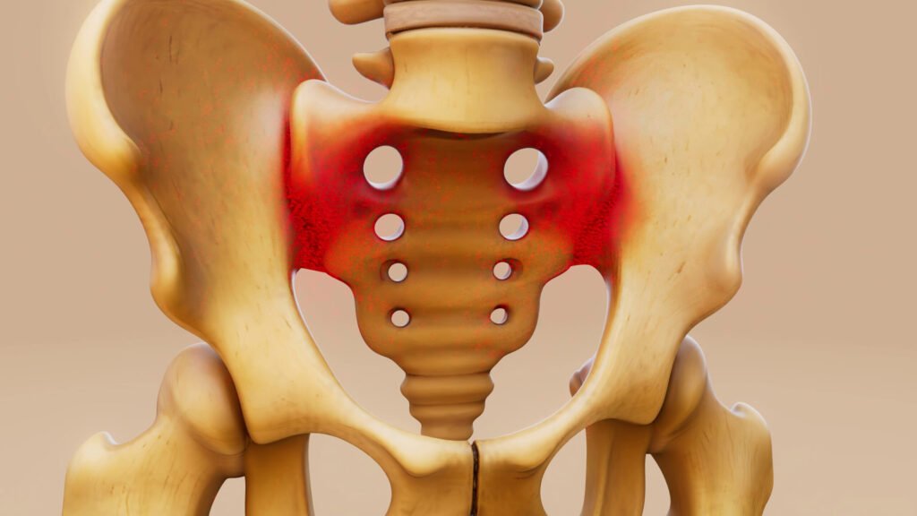 Bipolar Hemiarthroplasty