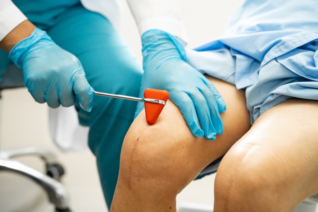 Arthroscopic ACL Reconstruction: Procedure & Recovery