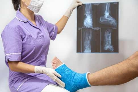 Hairline Fracture Ankle