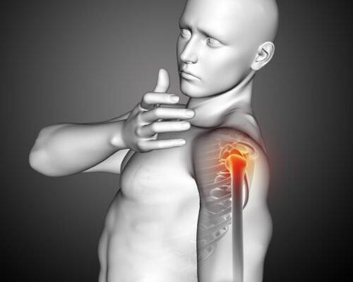 Common Causes of Rotator Cuff Injury
