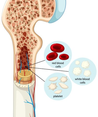Osteoporosis Treatment